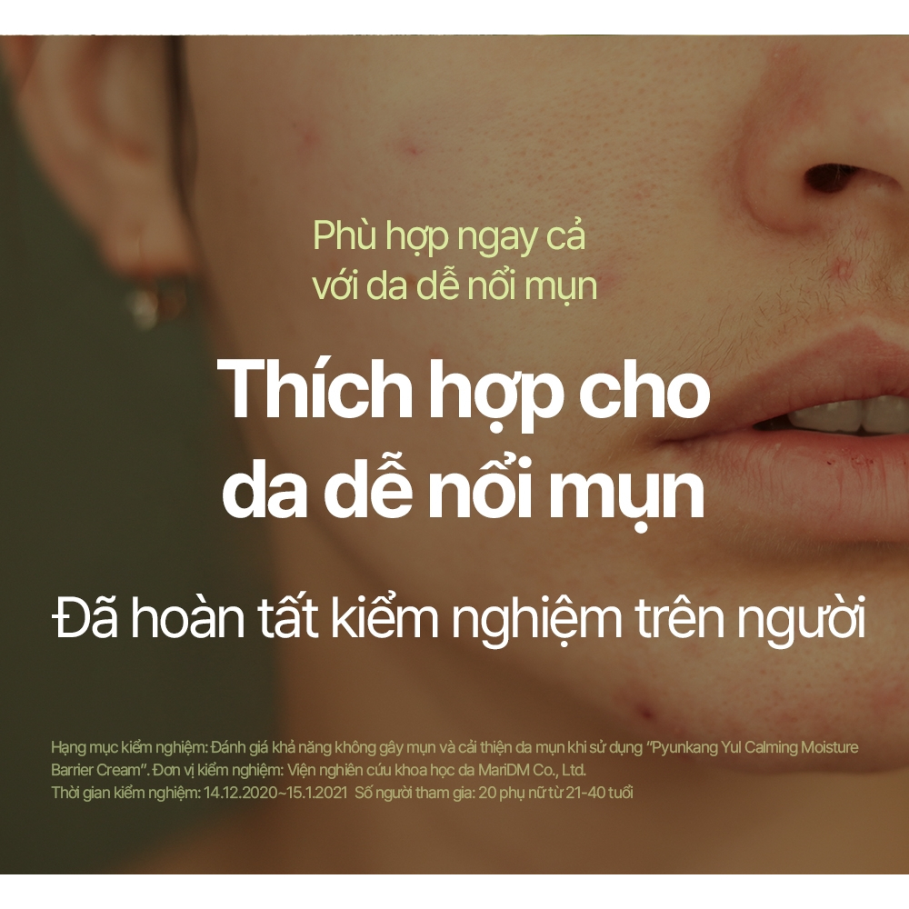 Thiết kế của Tuýp Kem Bôi