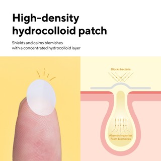 Miếng dán mụn caraseoul Spot Patches 74 miếng