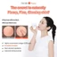 Collagen Bomb Hylifting Cream 100ml, Collagen thủy phân, + (Kem dưỡng mắt Collagen Bomb 7g quà tặng)