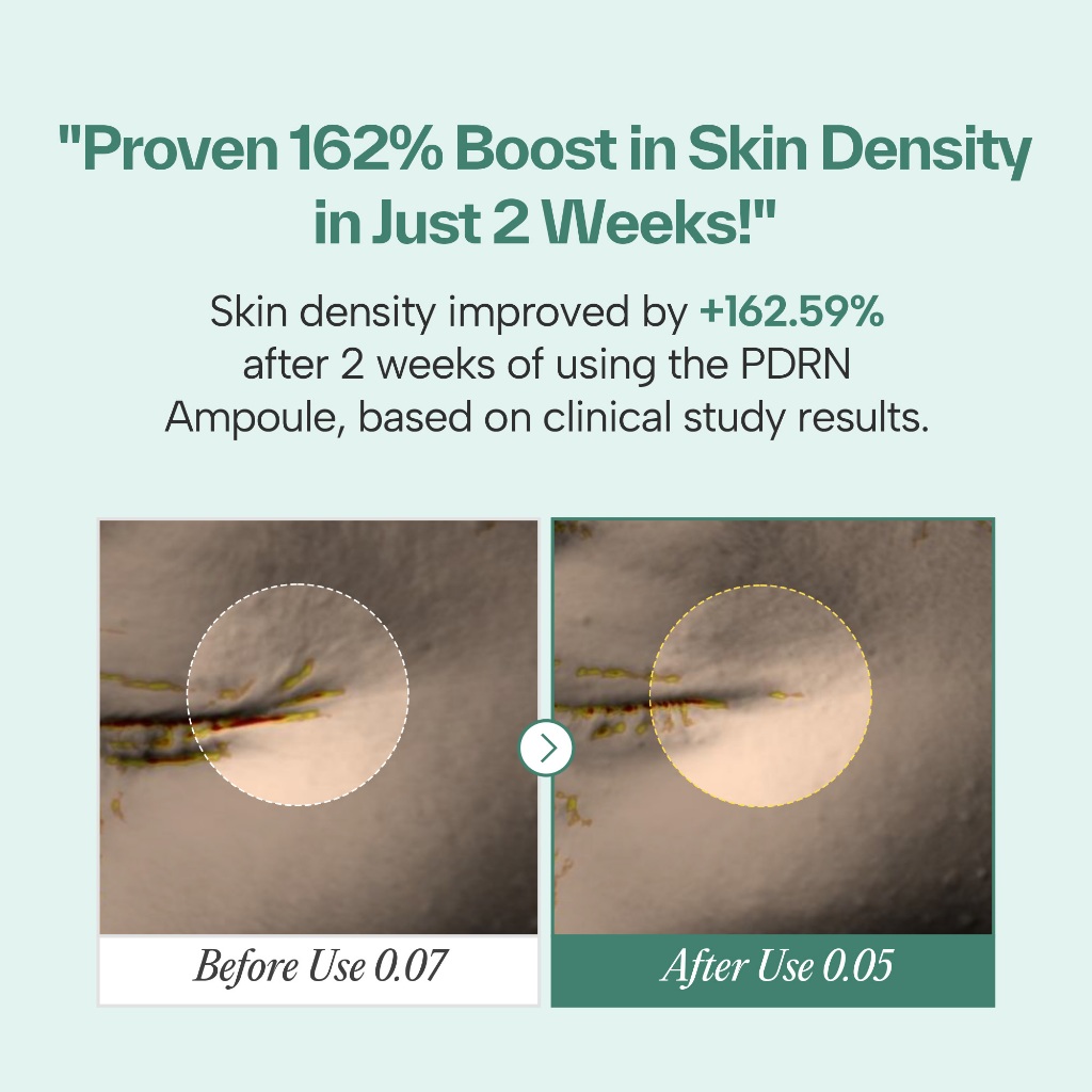 [Maybena] Bộ kem PDRN Ampoule +, Vegan PDRN Complex 730.000ppm (Chống nhăn, đàn hồi, rạng rỡ)