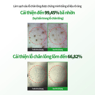 [SUNGBOON EDITOR] Sữa Rửa Mặt Whipping Làm Sạch Sâu Green Tomato Pore Cleansing Foam 120ml