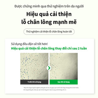 [SUNGBOON EDITOR] Tinh Chất Se Khít Lỗ Chân Lông Green Tomato Deep Shot Ampoule 30ml