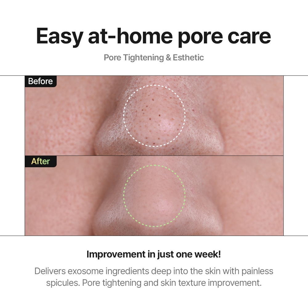 Clinto Pico Exosome Ampoule Pore & Acne (Rosemary Exosome, Spicule, AHA, BHA, PHA) (30ml * 1ea)