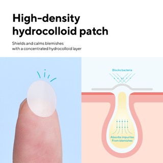 Miếng dán mụn caraseoul Spot Patches 102 miếng