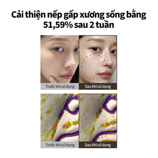 [SUNGBOON EDITOR] Ampoule Tinh chất nâng cơ chuyên sâu chứa peptide tơ tằm 35ml
