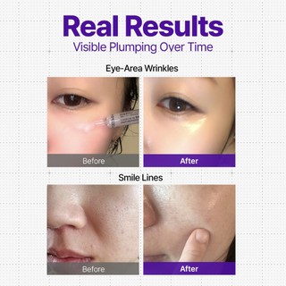 Differndeeper B-Volume Daily Shot (2,5ml × 2ea) Gói khởi động khác biệt & sâu hơn