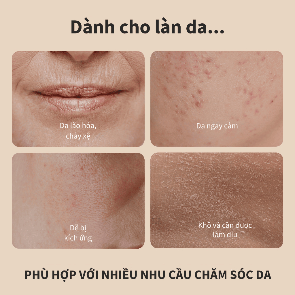 [Benton Official] Nước Hoa Hồng Snail Bee High Content – Dưỡng ẩm da mặt, chứa dịch nhầy ốc sên, cấp ẩm, hỗ trợ chăm sóc da dầu và da dễ nổi mụn
