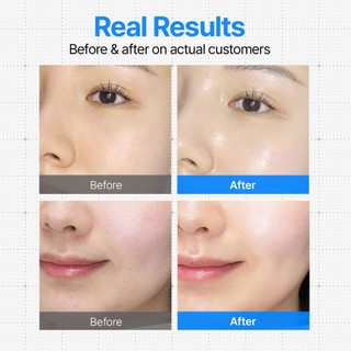 Kem lõi nước Ceraluronic DifferNdeeper 50g Khác biệt & Sâu hơn