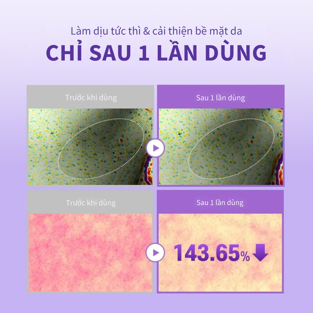 [Benton Official] Kem Lót Trang Điểm Guava Hydrating Make Up Base – Cấp ẩm, giúp lớp nền bám tốt và lâu trôi, hỗ trợ làm mờ lỗ chân lông, kiểm soát dầu, tạo hiệu ứng lì mịn và căng bóng, không chứa silicone