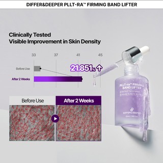 DIFFER & DEEPER PLLT-raTM Dụng cụ nâng dây buộc săn chắc 50g differndeeper