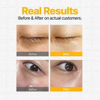 Kem dưỡng mắt làm sáng da DifferNdeeper – 30ml khác nhau & sâu hơn