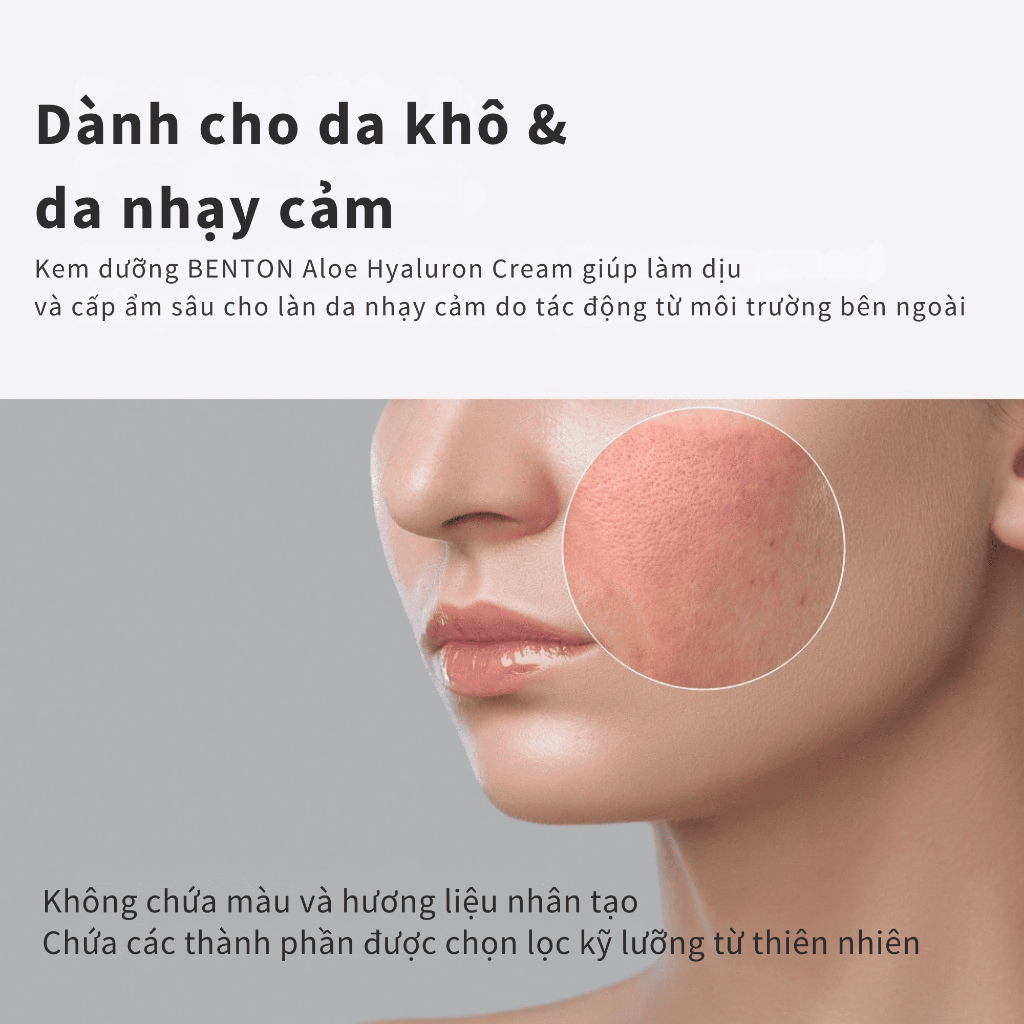 [Benton Official] Gel Dưỡng Làm Dịu Da Aloe Propolis – Làm dịu da, cấp ẩm sâu, dưỡng ẩm không chứa dầu