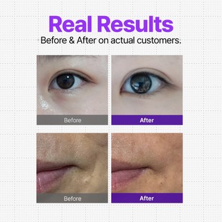 Kem dưỡng mắt làm săn chắc da DifferNdeeper 30ml khác nhau & sâu hơn