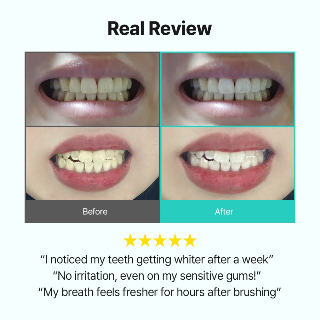 Kem đánh răng làm trắng da LiveOrals PureDia 20g | Cho nụ cười tươi sáng hàng ngày | Được phát triển bởi nha sĩ Hàn Quốc