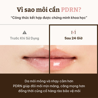 [Dr.Reju-All Official] PD0 Serum Dưỡng Môi Cấp Ẩm & Căng Bóng 10ml | Phục hồi môi, Tẩy tế bào chết môi, Môi căng mịn Dược mỹ phẩm Hàn Quốc, Mặt nạ môi, Son dưỡng môi