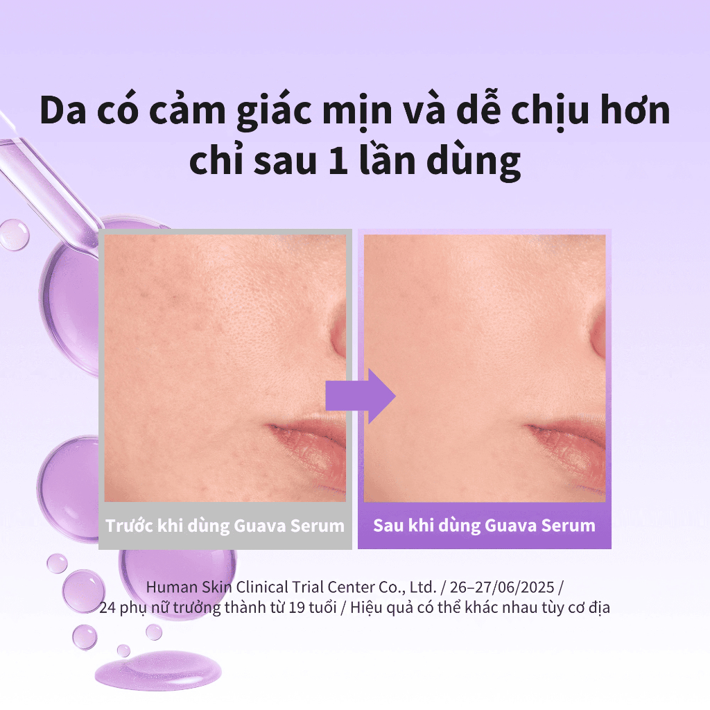 [Benton Official] Tinh Chất Guava Moisture Soothing Serum – Cấp ẩm, làm dịu, làm sáng da, hỗ trợ phục hồi hàng rào bảo vệ da, kết cấu mỏng nhẹ không bết dính, phù hợp da nhạy cảm và da dễ nổi mụn