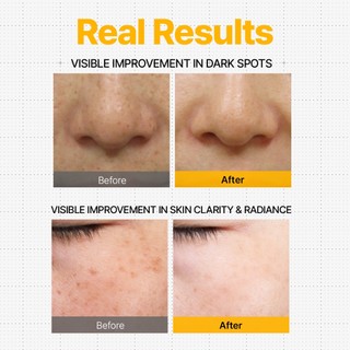 DifferNdeeper C-Toning Daily Shot (2,5ml × 2ea) Khác biệt & sâu hơn