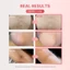 Dung dịch lột cơ thể AHA, PHA, BHA, LHA, Mặt nạ lột cơ thể, Gel tẩy tế bào chết rửa để làm sáng da, giảm thiểu lỗ chân lông (105ml)