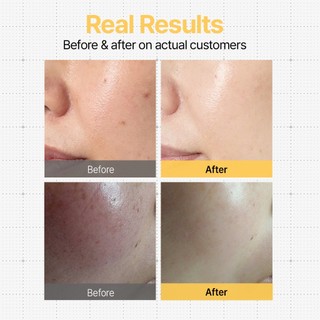 DifferNdeeper Brightening Toning Skin Booster 2ml x 5ea khác nhau & sâu hơn
