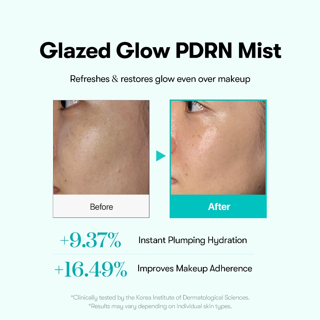 [VT] PDRN Glow Ampoule Mist 2 Trong 1 – Xịt Khoáng + Serum Căng Bóng Da Vegan PHYTO PDRN 10% Chỉ Cần 1 Sản Phẩm
