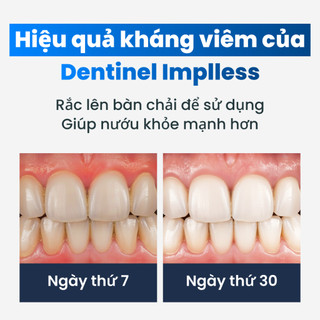 Bột đánh răng giảm sưng viêm nướu Dentinel Implless