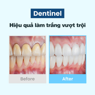 Viên đánh trắng răng Dentinel (50 viên) - Kem đánh răng dạng viên bỏ túi, Giảm ố vàng, Bảo vệ nướu, Ngừa sâu răng