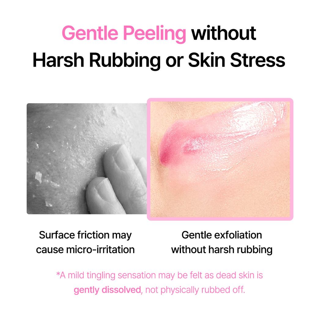 [LEPS] Mặt nạ lột da | PHA, AHA, BHA, Vitamin B12 | Gel Peeling Serum Wash-Off Mask, Brightening, Loại bỏ mụn trứng cá / mụn đầu đen, mụn đầu trắng (105ml)
