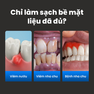 Bột đánh răng giảm sưng viêm nướu Dentinel Implless