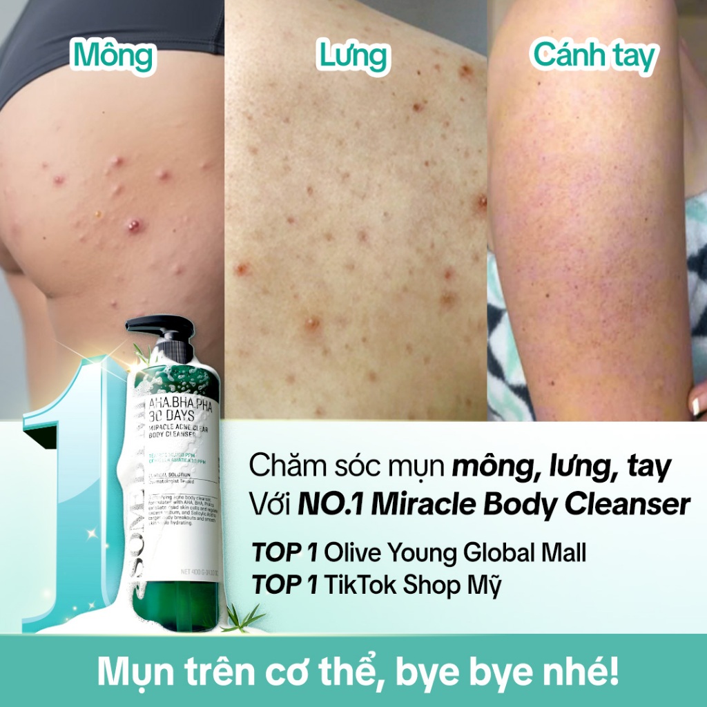 [SOMEBYMI] Sữa tắm giảm mụn AHA-BHA-PHA 30 Days Miracle Acne Clear Body Cleanser 400g