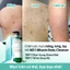 Sữa tắm giảm mụn AHA-BHA-PHA 30 Days Miracle Acne Clear Body Cleanser 400g
