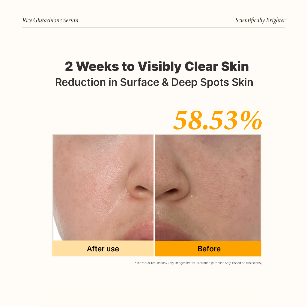 [Nuriglow x Maybena] Bộ làm sáng da 14 ngày | Glow Serum Gạo Glutathione + Mặt nạ Retinol 30 miếng