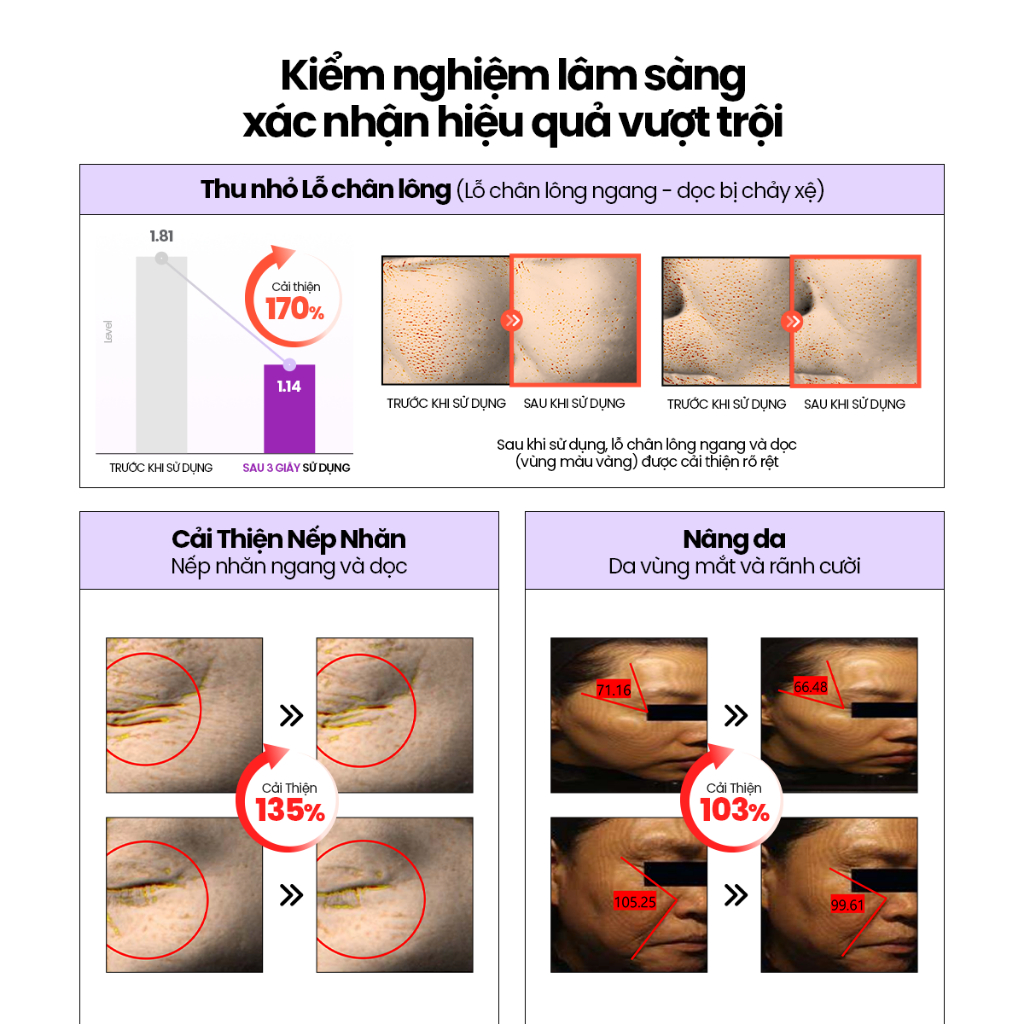 [DEWYTREE] Pad Thu Nhỏ Lỗ Chân Lông Pick and Quick Double Pad 10 Miếng