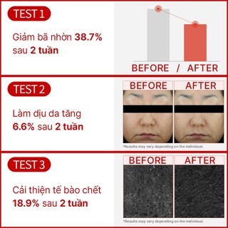 Serum Niacinamide 10% Thu Nhỏ Lỗ Chân Lông Phục Hồi Da Mụn Kiềm Dầu 50ml ENCA