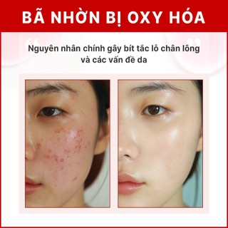 Serum Niacinamide 10% Thu Nhỏ Lỗ Chân Lông Phục Hồi Da Mụn Kiềm Dầu 50ml ENCA