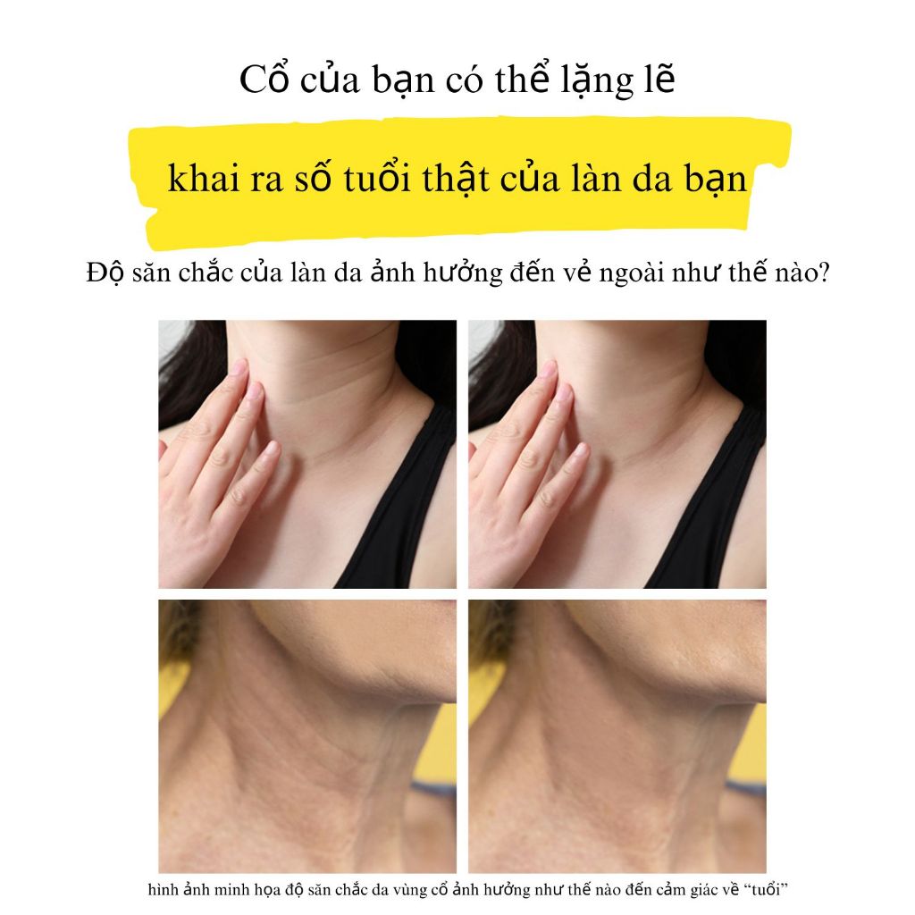 Kem Dưỡng Cổ Hàn Quốc BnD – Làm Săn Chắc & Dưỡng Trắng Vùng Da Cổ & Hàm, Dưỡng Ẩm Chống Lão Hó - 50ml