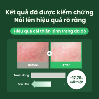 Sữa dưỡng thể giảm viêm lỗ chân lông deNONG Silky & Soft 500ml