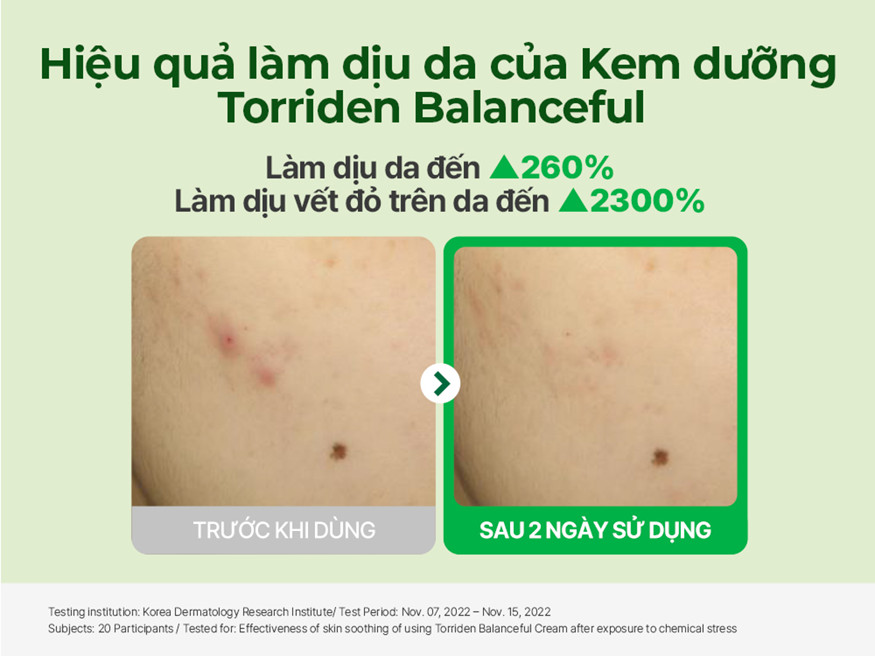 Thành phần kem dưỡng Torriden CICA