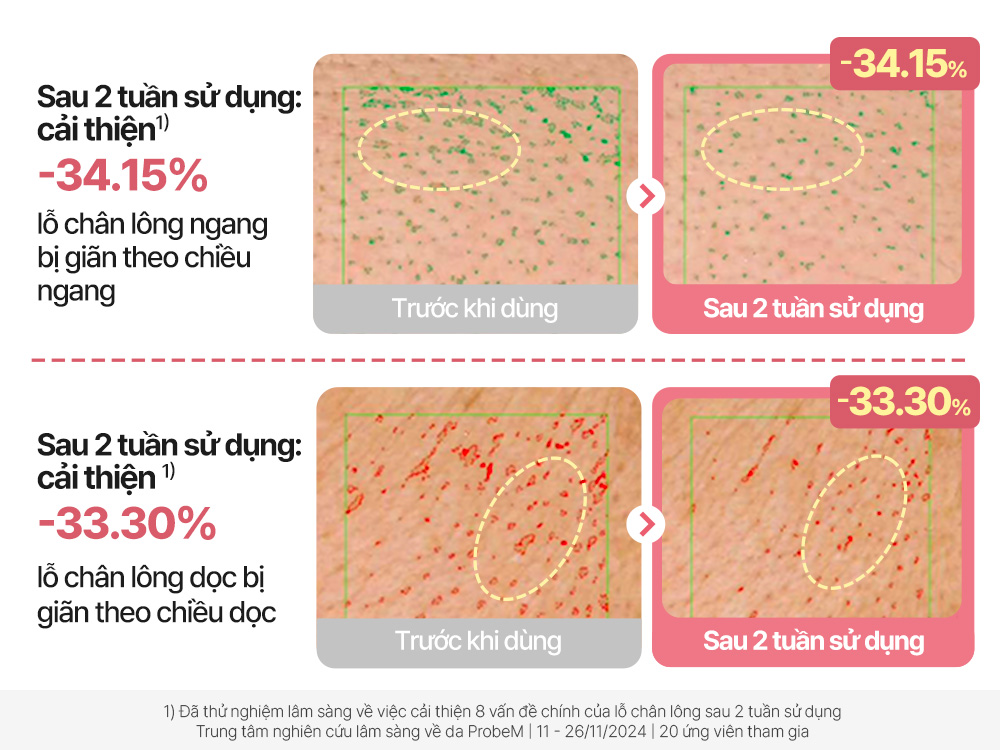 Mô tả Tinh chất chăm sóc lỗ chân lông hoàn hảo CELLMAZING, 30ml, Ampoule - 4
