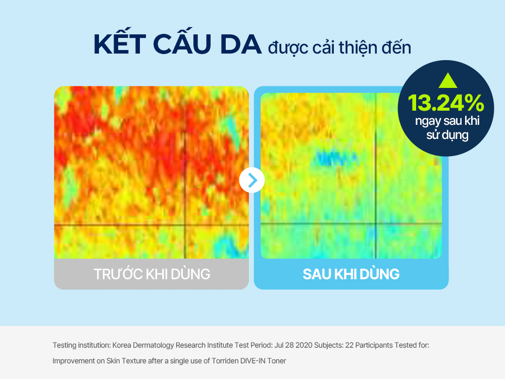 Công dụng Toner Torriden DIVE IN MINI