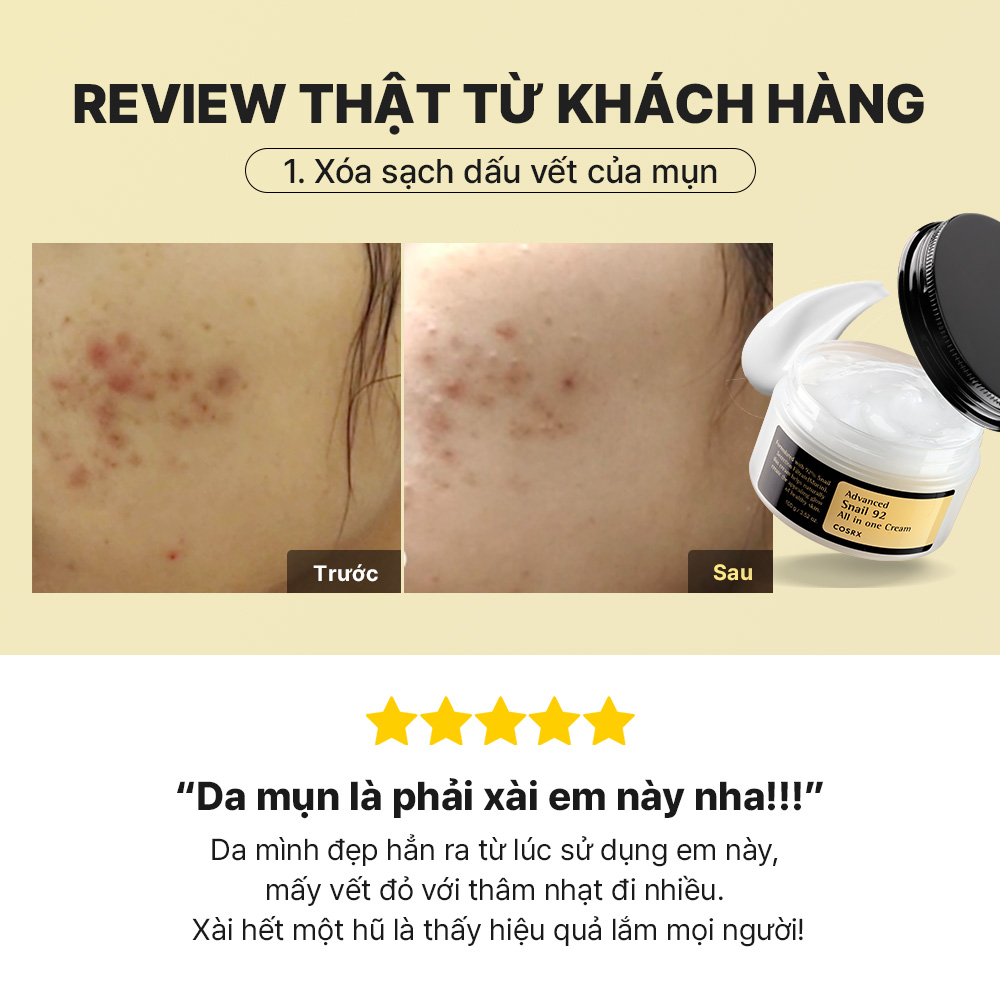 Mô tả Kem dưỡng ẩm cosrx tái tạo phục hồi da chiết xuất 92% dịch ốc sên tất cả trong một 100ml - 5