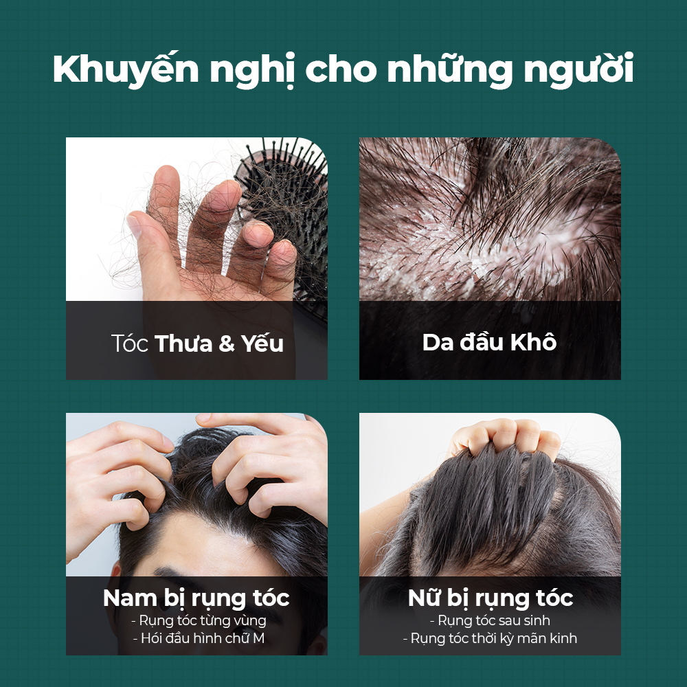 Mô tả Dầu gội Root Booster 500ml [Dầu gội chống rụng tóc số 1, 22 loại axit amin, 6 loại nguyên liệu tự nhiên] - 7