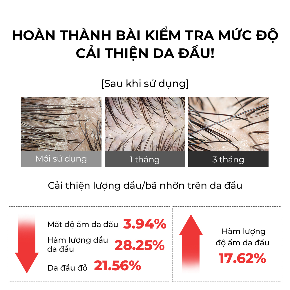 Mô tả Dầu Gội Zero-Dirty 500ml [Làm Sạch Sâu, Giảm Kích Ứng, Dầu Hạt Nho & Axit Hyaluronic] - 5