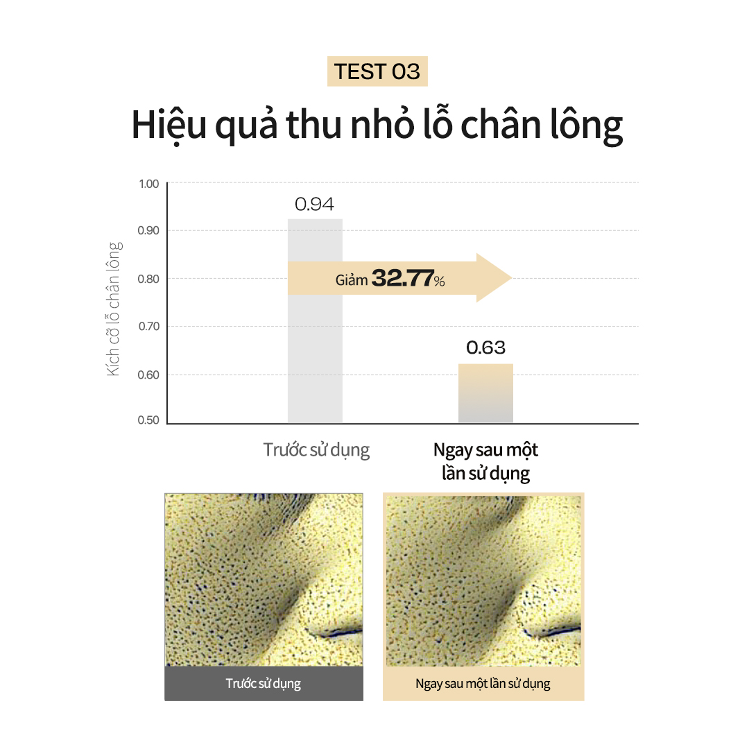 Mô tả Toner serum cải thiện lỗ chân lông, dưỡng ẩm lên tới 100 giờ 180ml (Bản nâng cấp) - 7