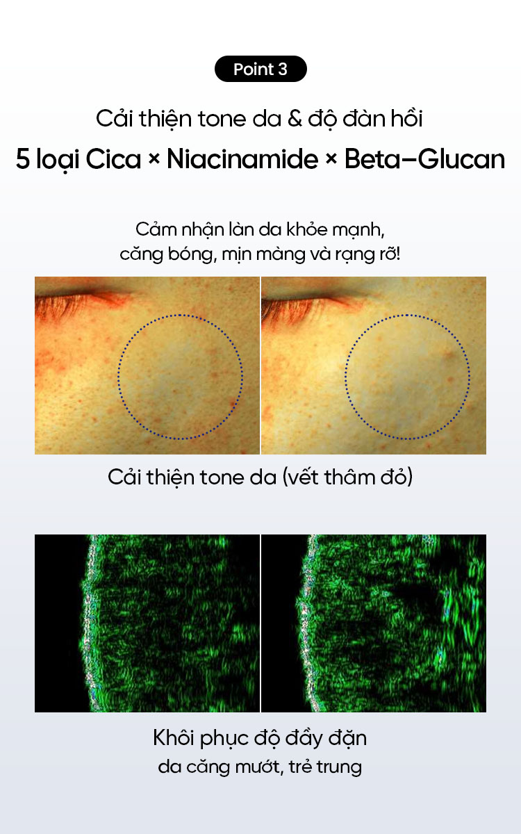 Mô tả Tinh chất BEPLAIN PDRN Rau Má phục hồi & tái sinh tổn thương cho da trẻ hoá, cấp ẩm & căng bóng Cica PDRN Skin Booster Serum 30ml - 12