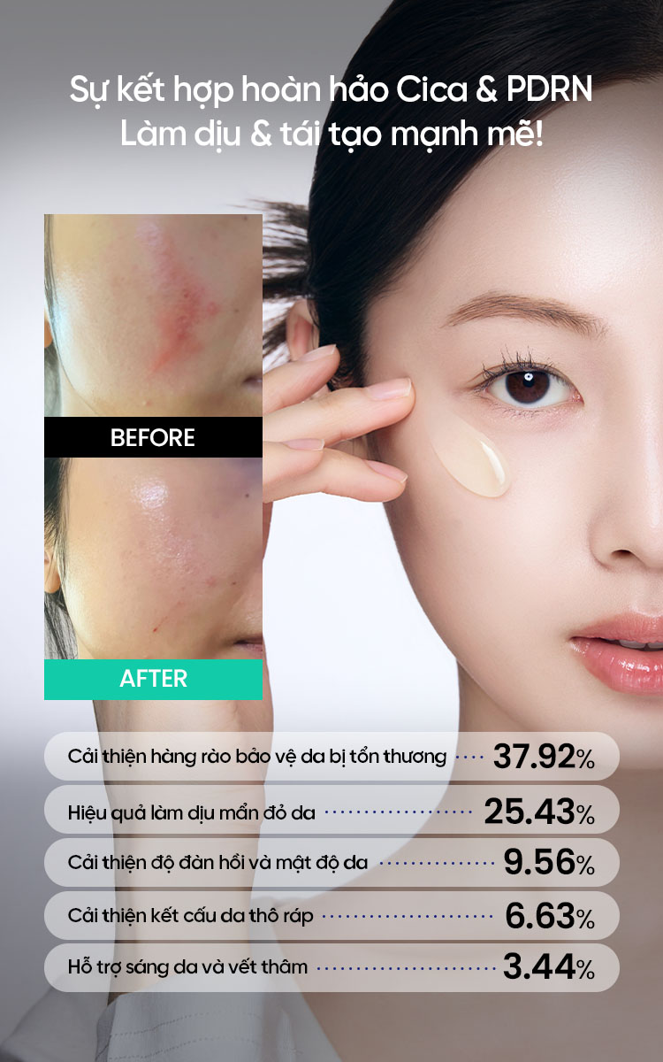 Mô tả Tinh chất BEPLAIN PDRN Rau Má phục hồi & tái sinh tổn thương cho da trẻ hoá, cấp ẩm & căng bóng Cica PDRN Skin Booster Serum 30ml - 5