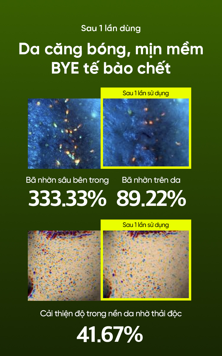 Mô tả Toner Đậu Xanh chứa PHA, AHA và LHA cân bằng độ pH, thải độc & tẩy da chết hiệu quả 265ML - 5