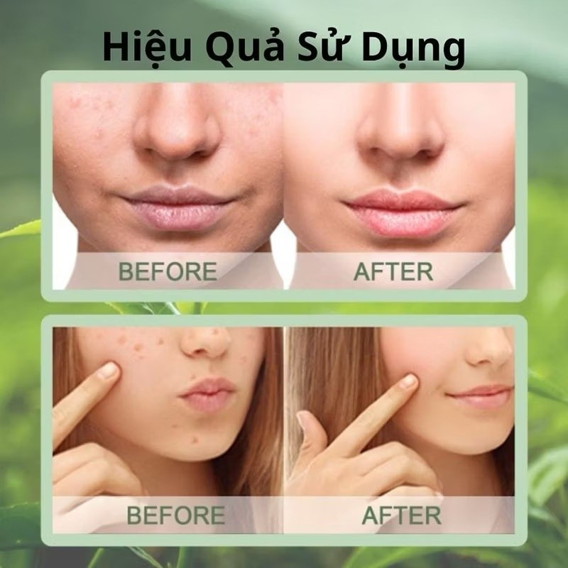 【Adel Floro &Co.】Que Mặt Nạ Đất Sét - Hút sạch bã nhờn, Cấp ẩm, Se khít lỗ chân lông, Mịn da