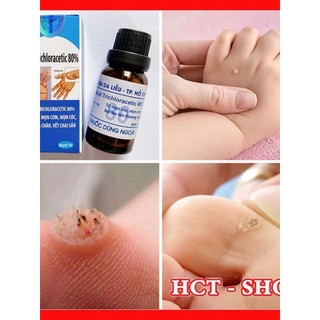 Lọ chấm tẩy mụn cơm, mụn cóc, mụn thịt, nốt ruồi, vết chai sần