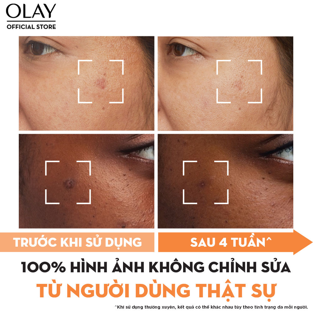 Ảnh Kem Dưỡng Ẩm OLAY LUMINOUS NIACINAMIDE + VITAMIN C 50G Mờ Vết Thâm, Đốm Nâu, Dưỡng Sáng Da 4