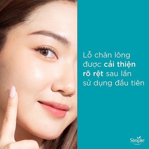 NƯỚC TẨY TRANG SẠCH SÂU DỊU NHẸ - SIMPLE MICELLAR WATER 400ML | BigBuy360 - bigbuy360.vn